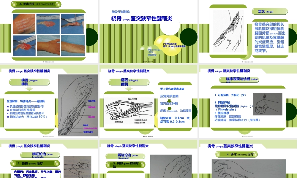 2022年医学专题—腕及手部部筋伤(下).ppt