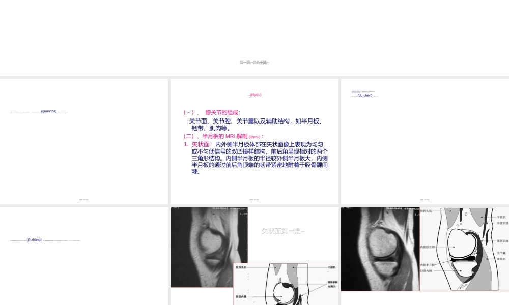 2022年医学专题—膝关节创伤的MRI.ppt