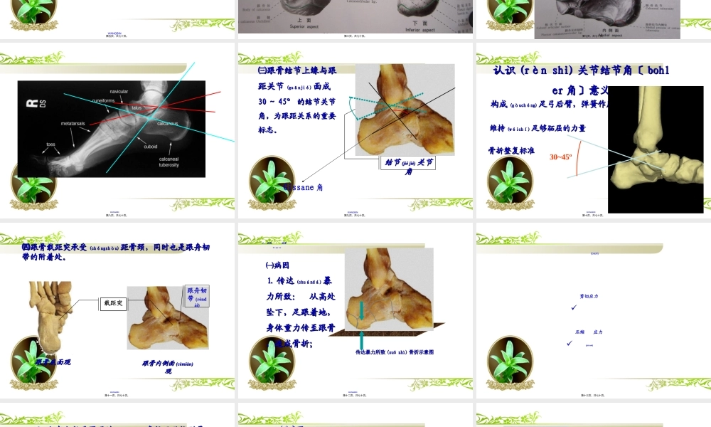 2022年医学专题—跟骨骨折.ppt