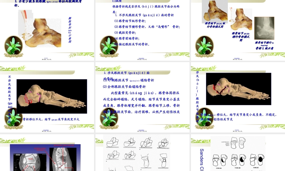 2022年医学专题—跟骨骨折.ppt