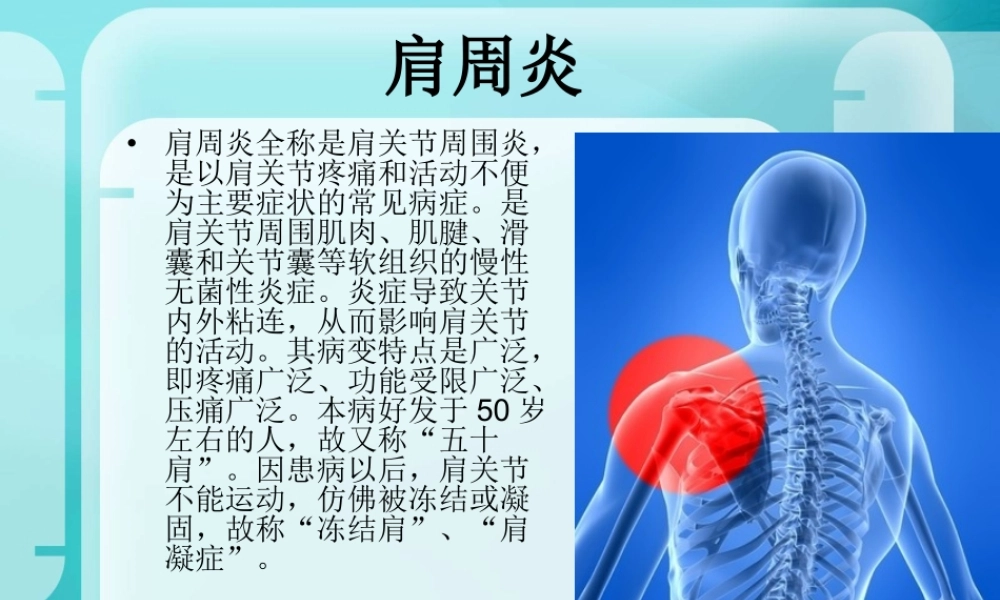 26骨科-肩周炎(1).ppt