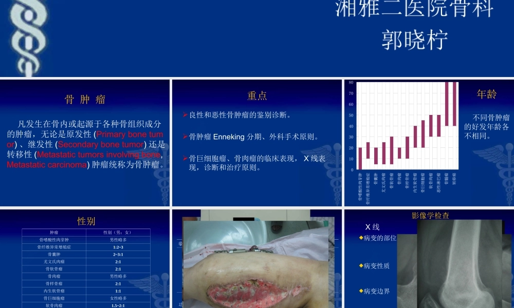 25骨科-骨肿瘤-郭晓柠(1).ppt