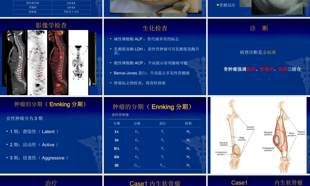25骨科-骨肿瘤-郭晓柠(1).ppt