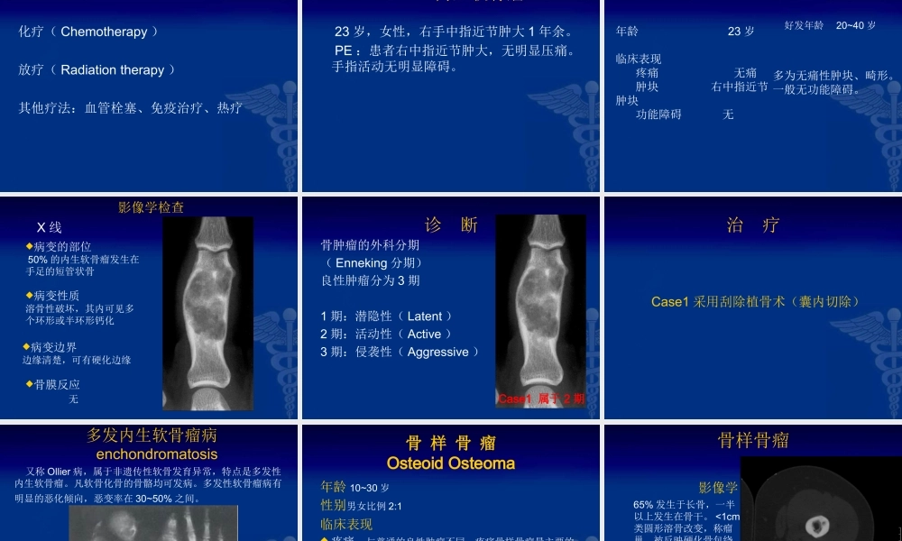 25骨科-骨肿瘤-郭晓柠(1).ppt