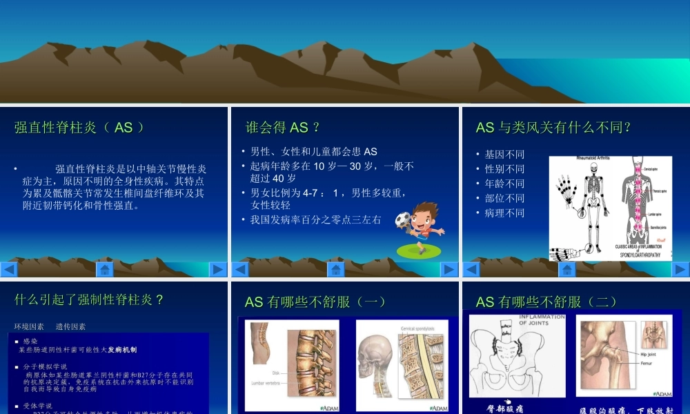 32骨科-强直性脊柱炎的护理(1).ppt