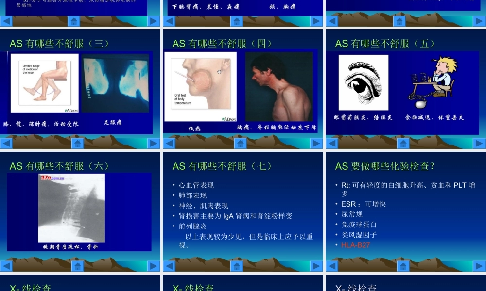 32骨科-强直性脊柱炎的护理(1).ppt