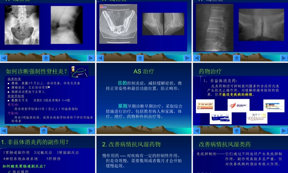 32骨科-强直性脊柱炎的护理(1).ppt