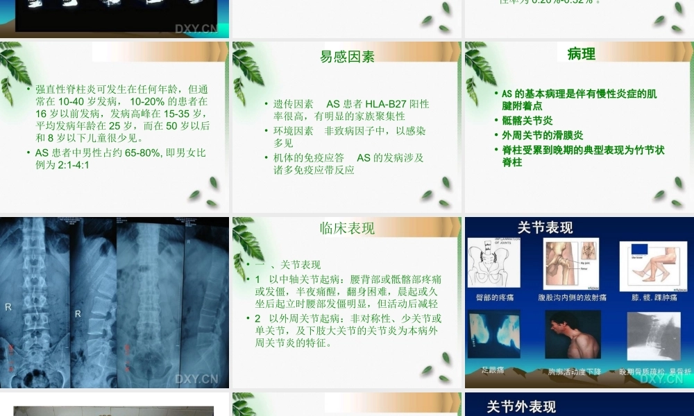 31骨科-强直性脊柱炎(1).ppt