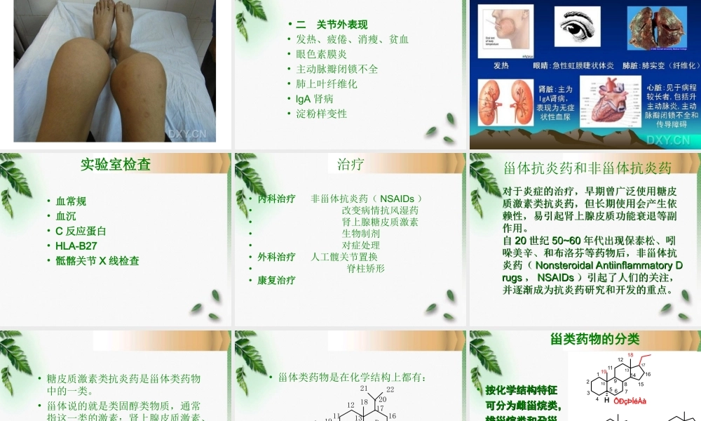 31骨科-强直性脊柱炎(1).ppt