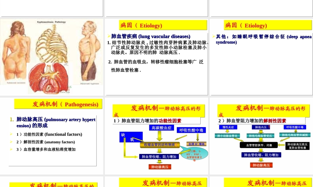 37呼吸内科-肺源性心脏病(1).ppt