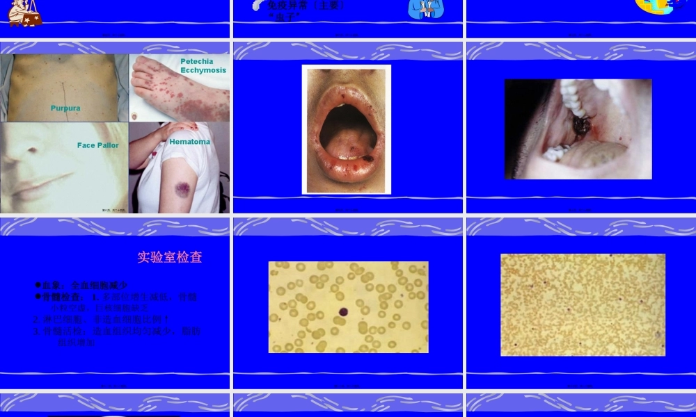 3再生障碍性贫血.pptx