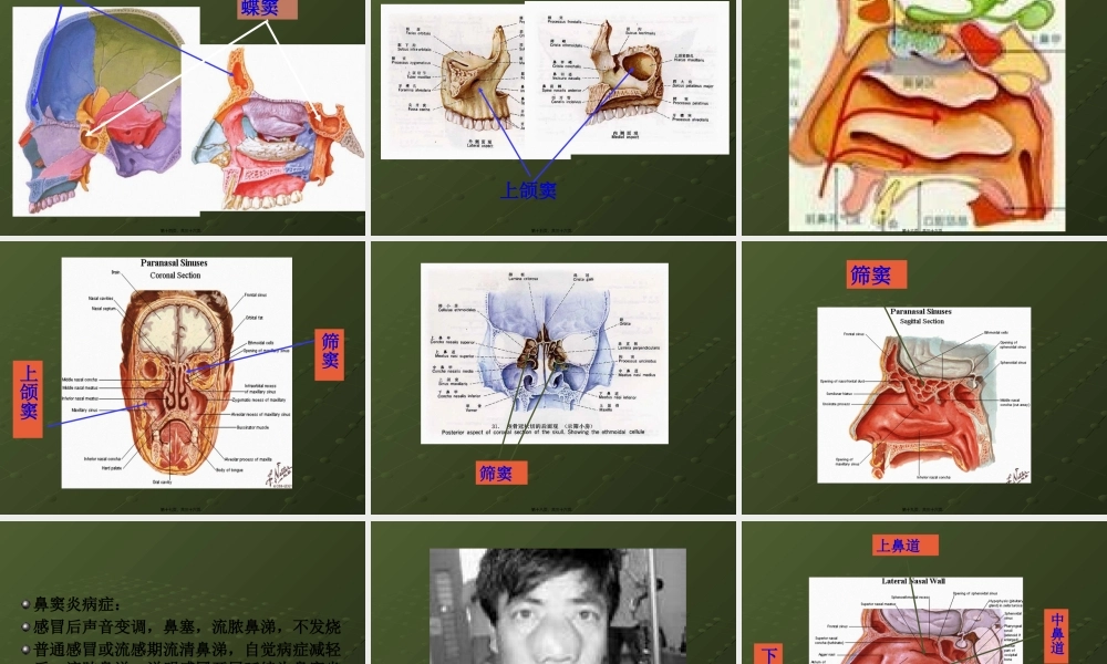 3感冒与鼻窦炎.pptx