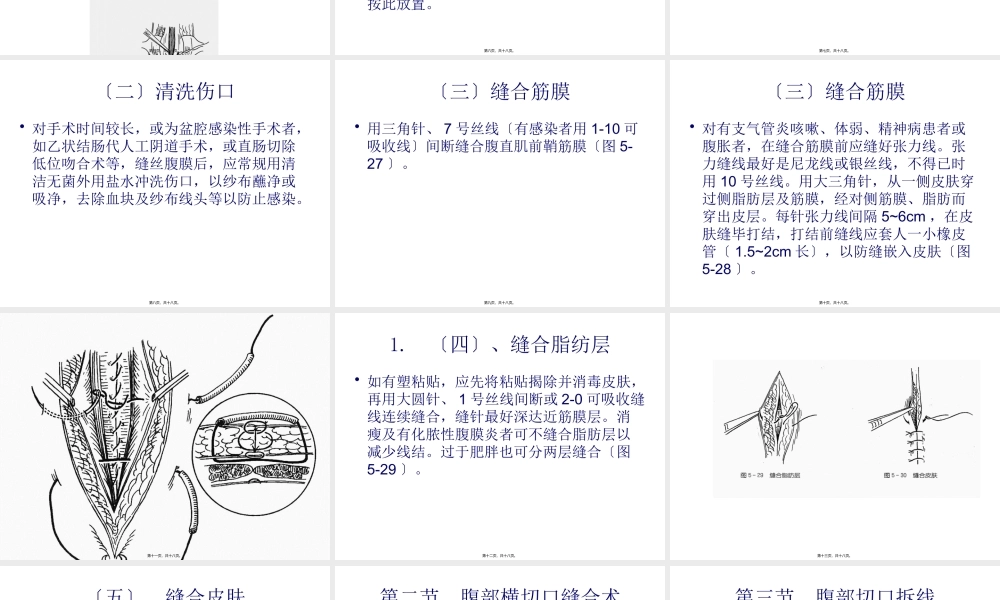 3月腹部切口缝合术.pptx