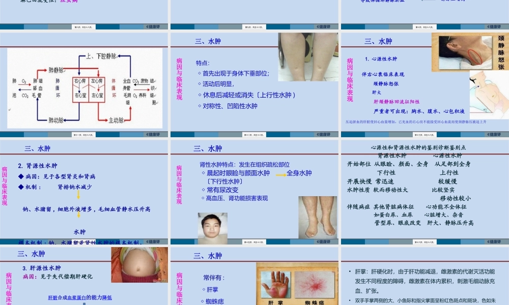 3水肿脱水新.pptx