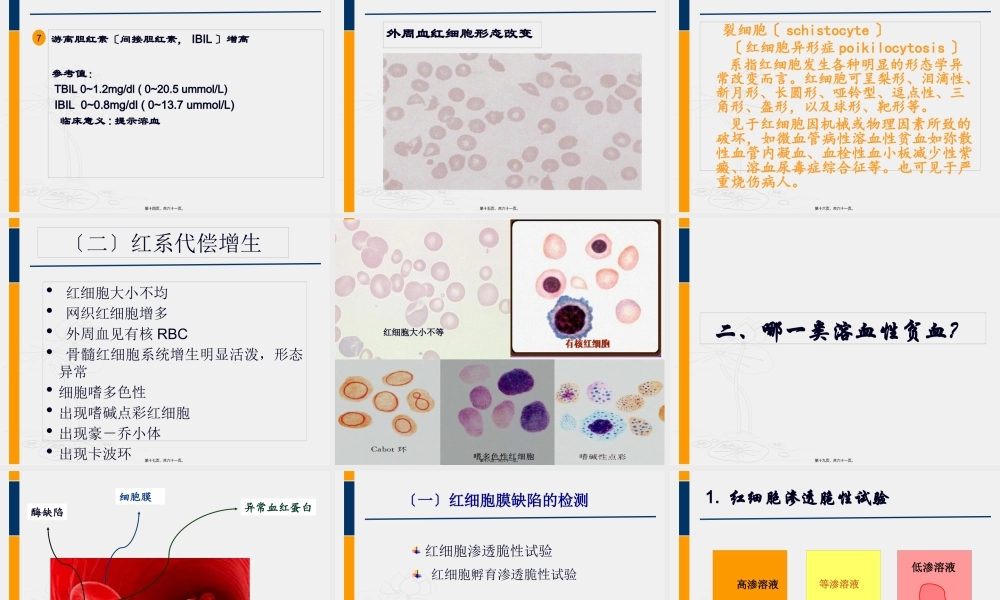 3溶血性贫血.pptx