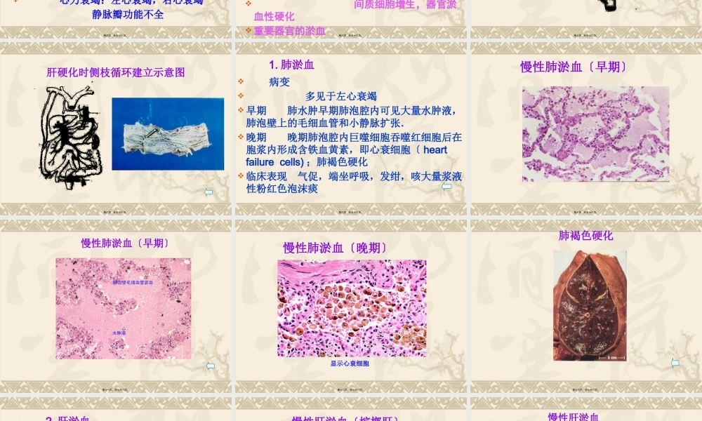 3血液循环障碍-PPT文档.pptx
