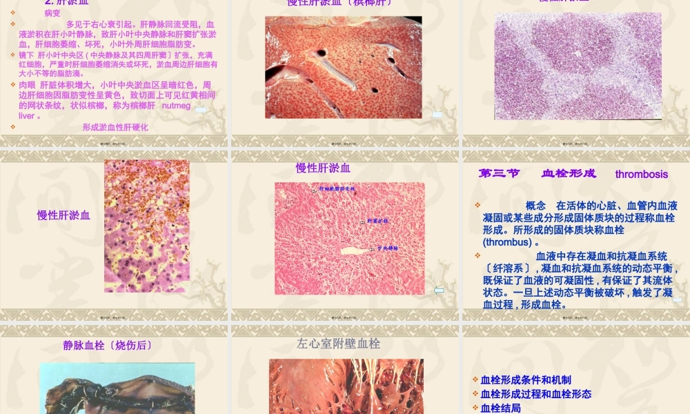 3血液循环障碍-PPT文档.pptx
