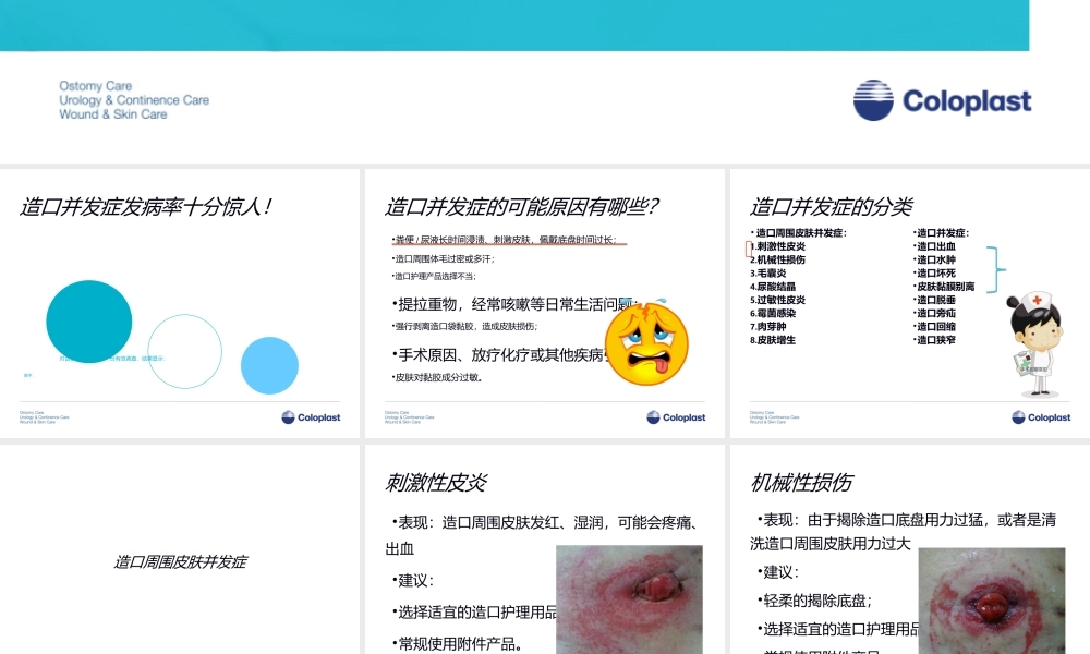 3造口并发症介绍.ppt