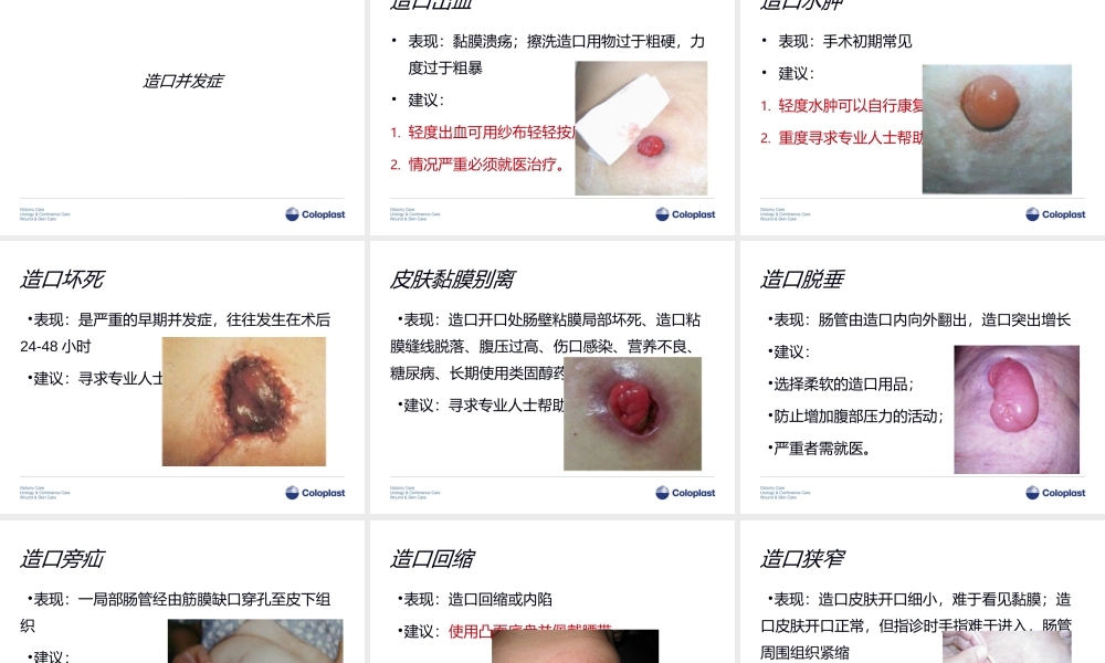 3造口并发症介绍.ppt