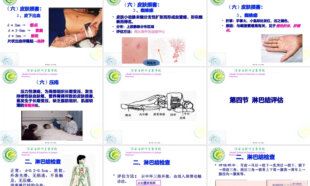 4.皮肤、淋巴结的评估.pptx