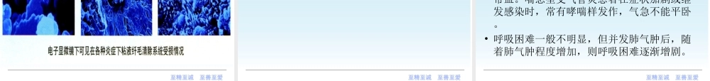 41呼吸内科-慢性支气管炎课件2012(1).ppt