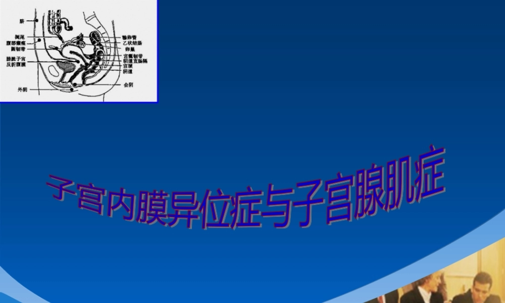 46子宫内膜异位症和子宫腺肌病.pptx