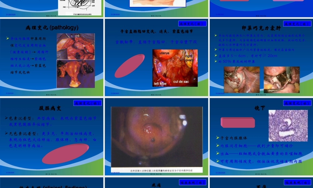 46子宫内膜异位症和子宫腺肌病.pptx