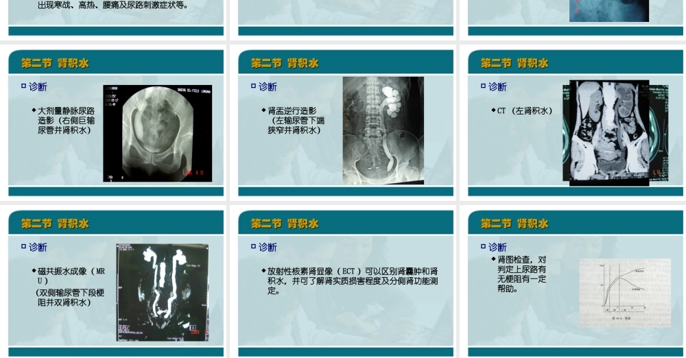47泌尿科-泌尿系统梗阻(1).ppt