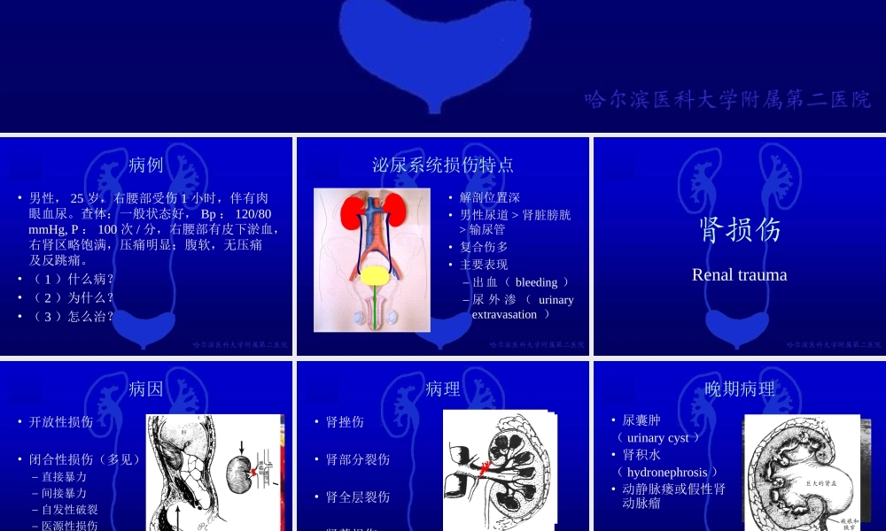 49泌尿科-泌尿系统损伤(1).ppt