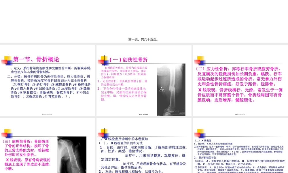 4第四章、骨关节损伤2.pptx