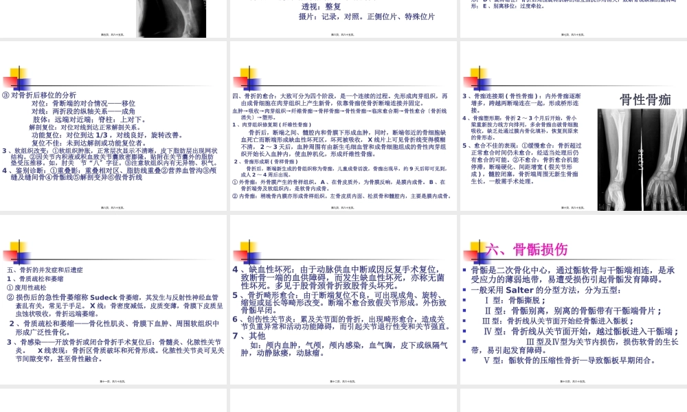 4第四章、骨关节损伤2.pptx
