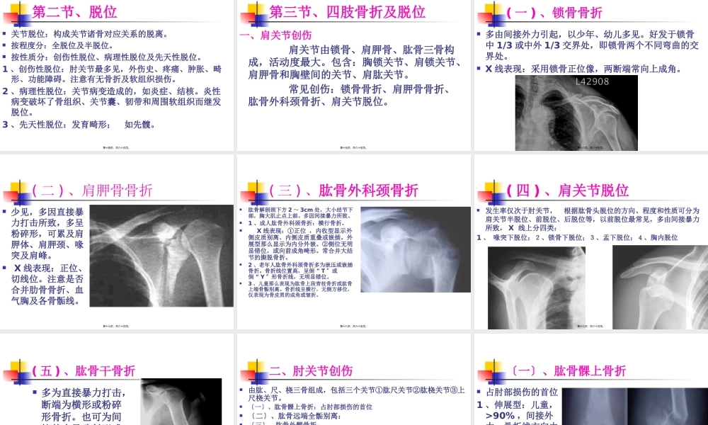 4第四章、骨关节损伤2.pptx