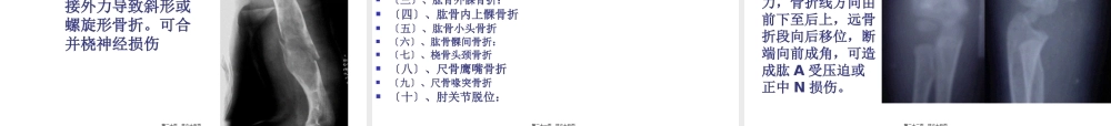 4第四章、骨关节损伤2.pptx