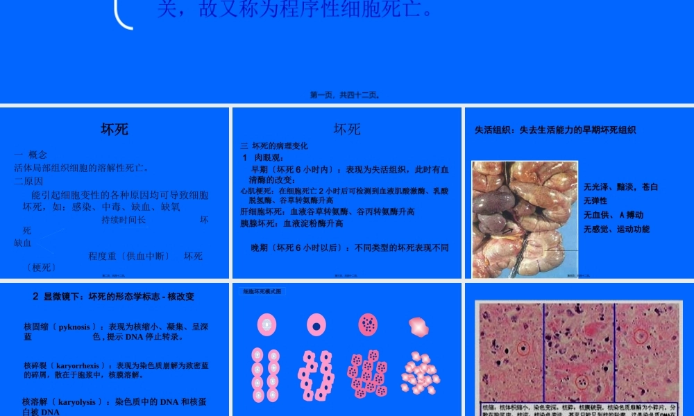 4组织细胞损伤坏死.pptx