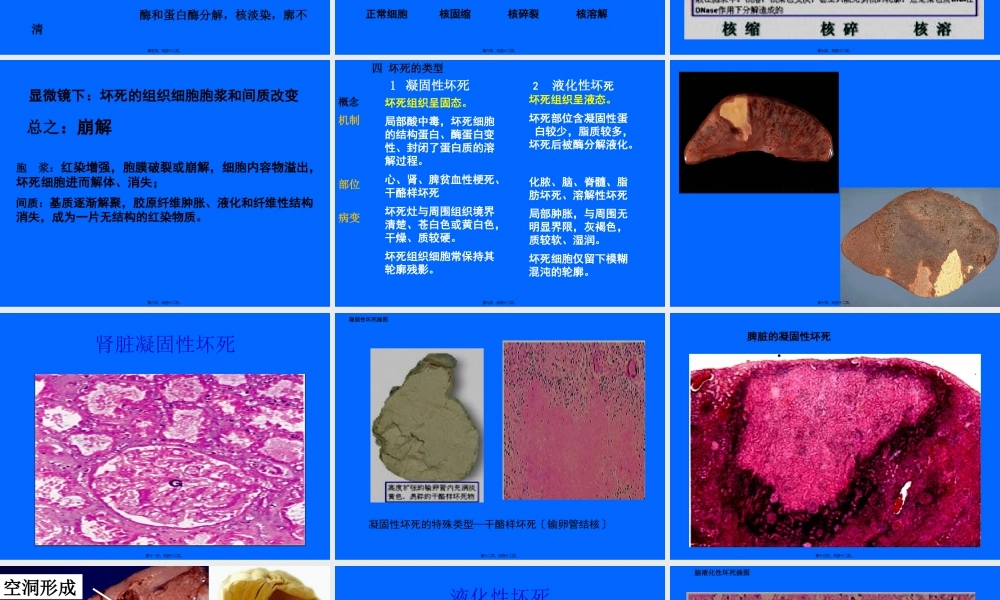 4组织细胞损伤坏死.pptx