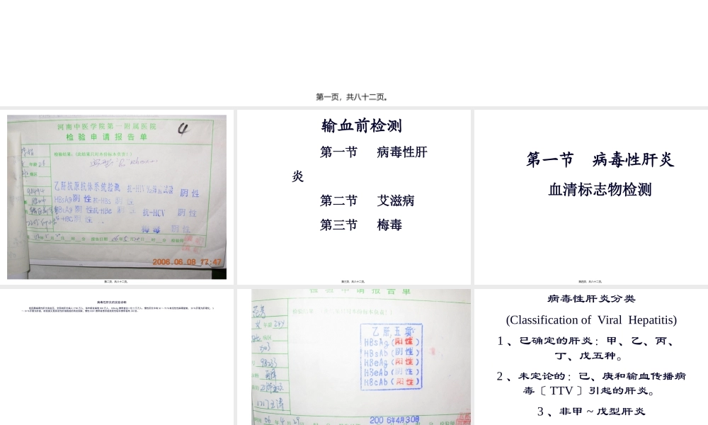 5..输血前有关检查.pptx