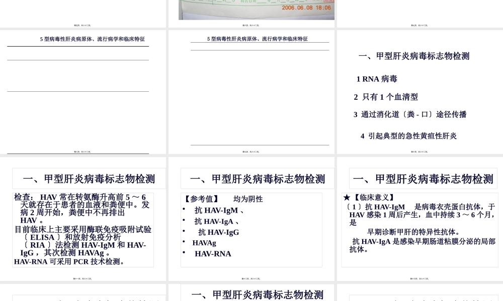 5..输血前有关检查.pptx