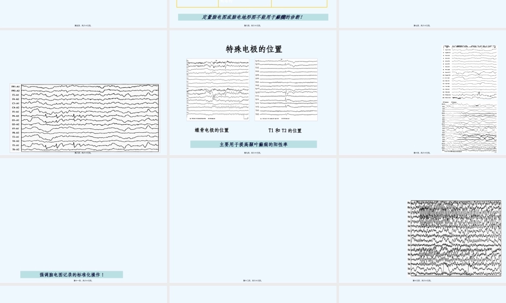 5.1515-1645.脑电图的应用和结果判定.pptx