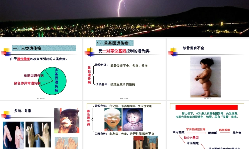 5.3-人类遗传病汇总.pptx