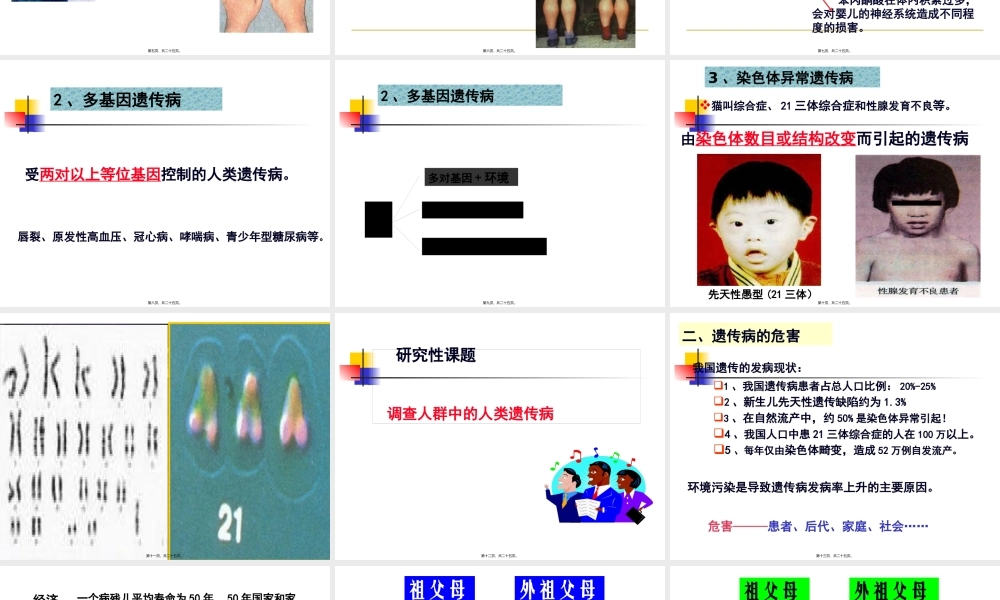 5.3-人类遗传病汇总.pptx