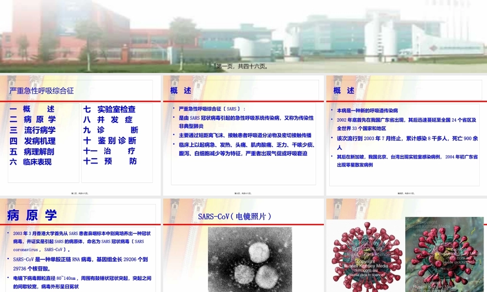 5.严重急性呼吸综合征.pptx