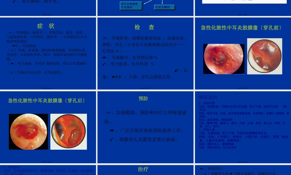5.急性化脓性中耳炎.pptx