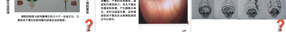 55男科-前列腺PPT(1).ppt