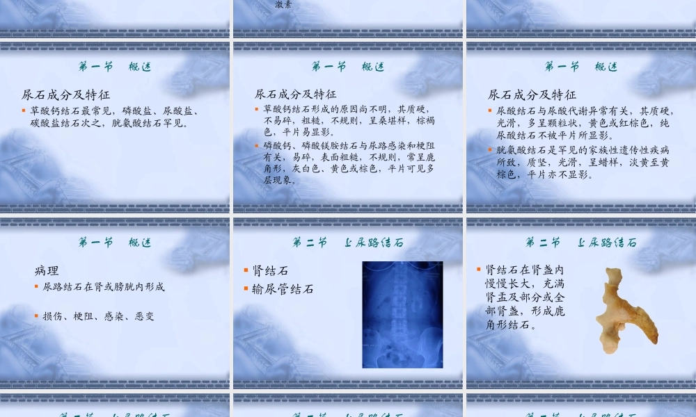 53泌尿科-尿石症(1).ppt