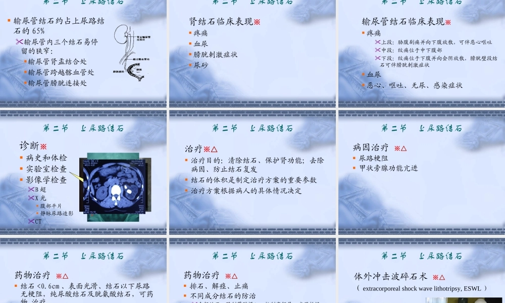 53泌尿科-尿石症(1).ppt