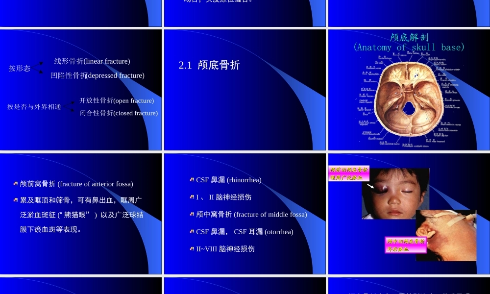 58脑外科-颅脑损伤(1).ppt