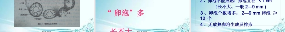 5、多囊卵巢综合症(PCOS).pptx