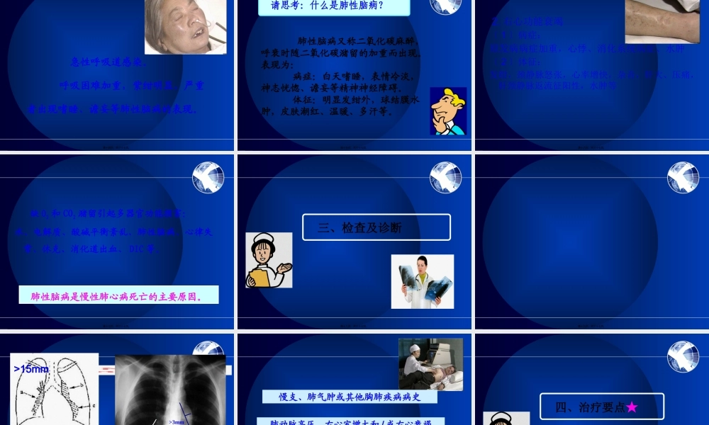 5慢性肺源性心脏病.pptx