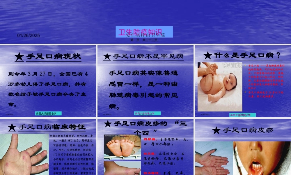 5手足口病防治知识讲座.pptx