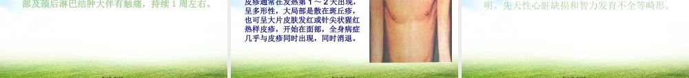 5托幼机构传染病防控.pptx